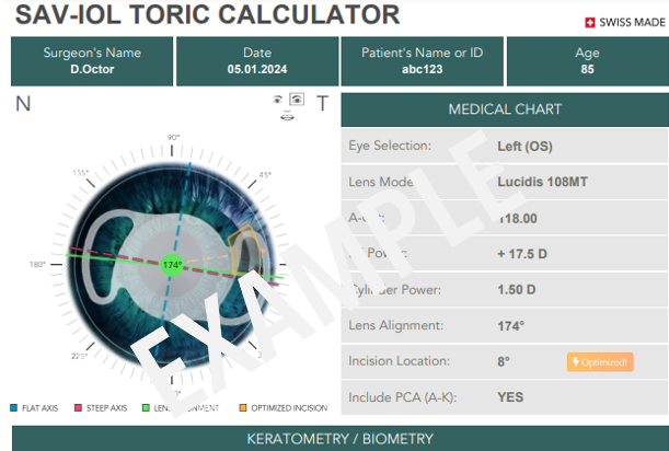 Toric Calculator – Launch of New Features
